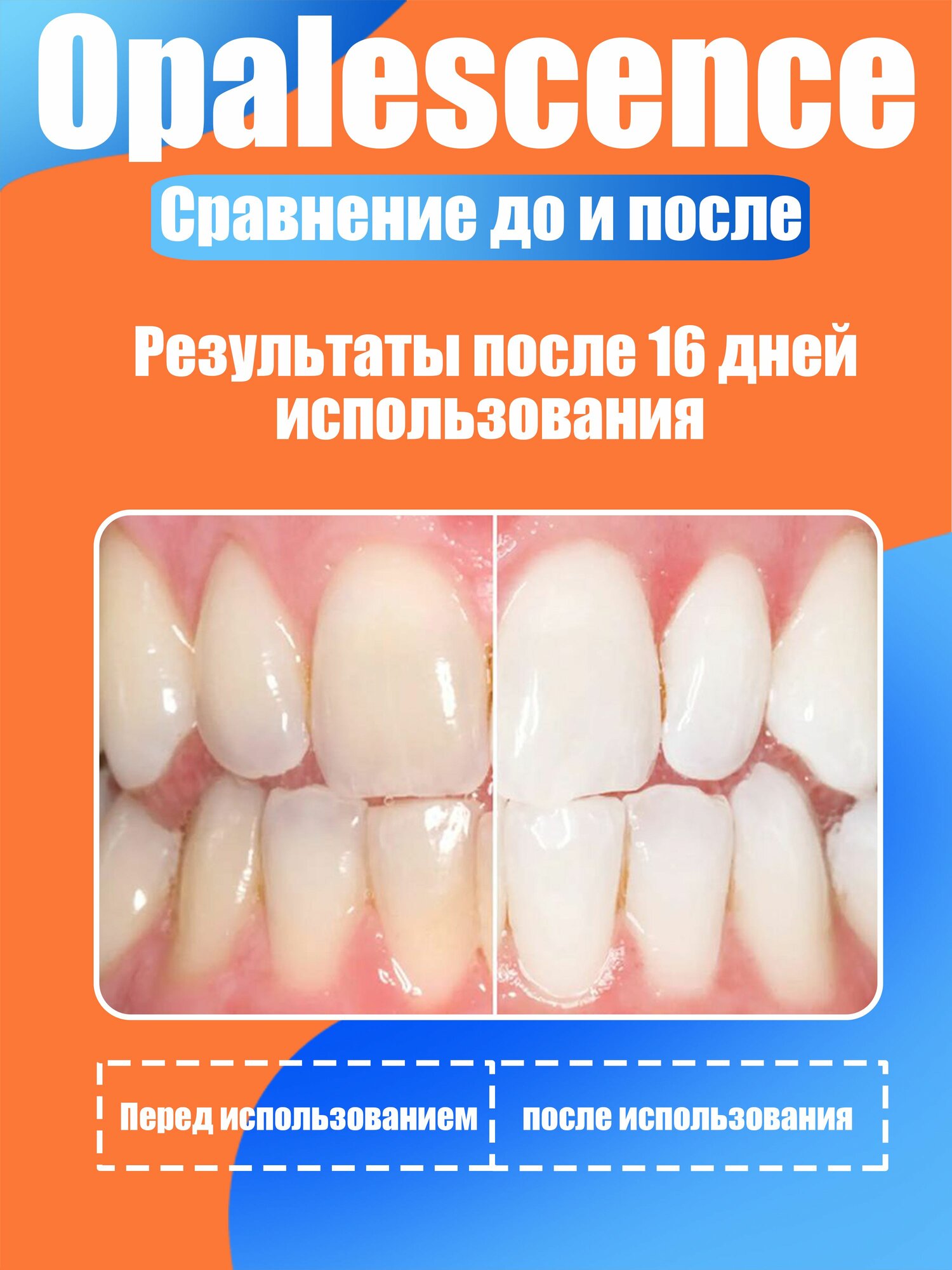 Изображение Отбеливающий комплекс