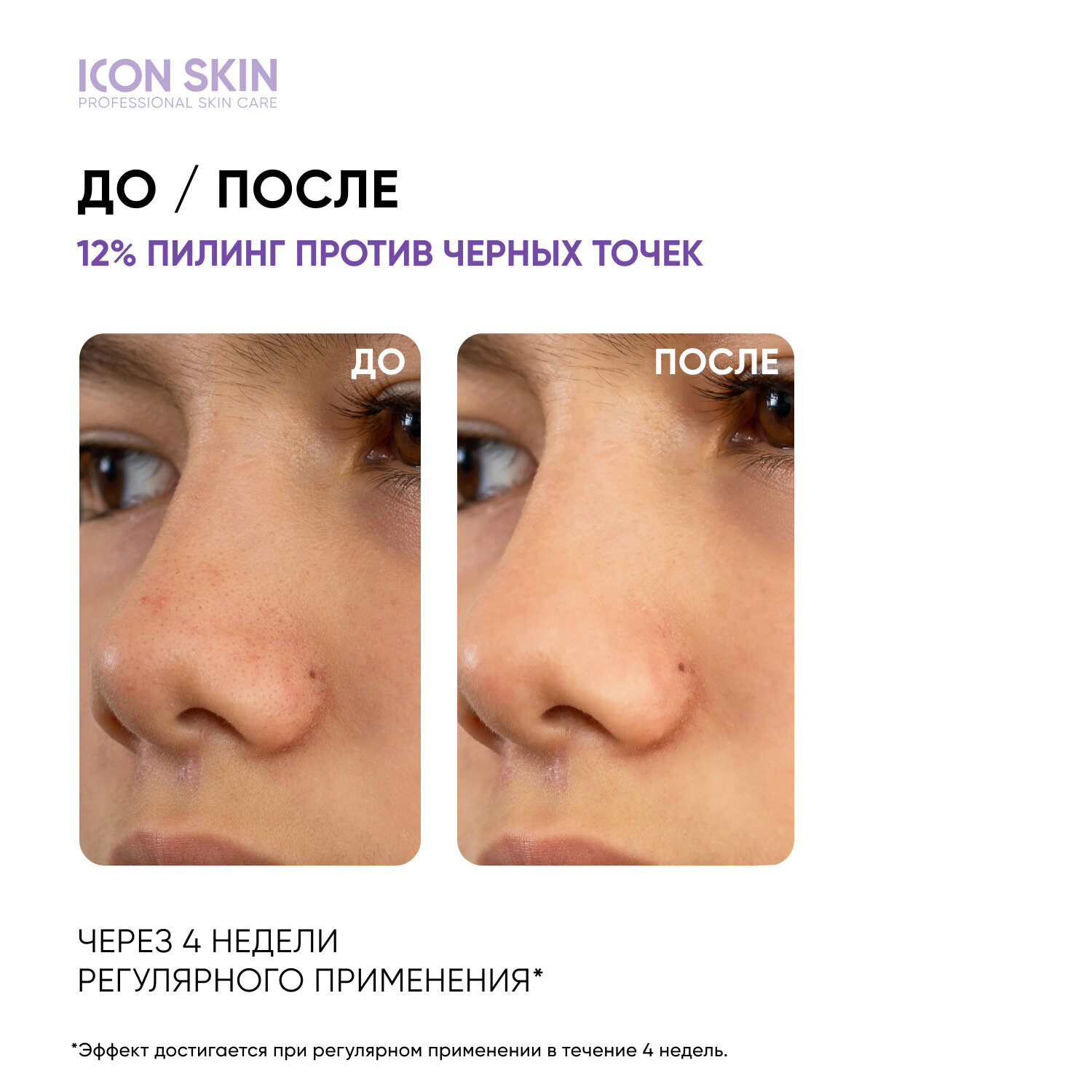 ICON SKIN / Обновляющий пилинг с 12% комплексом кислот AHA + BHA. Проф. уход. Для всех типов кожи.