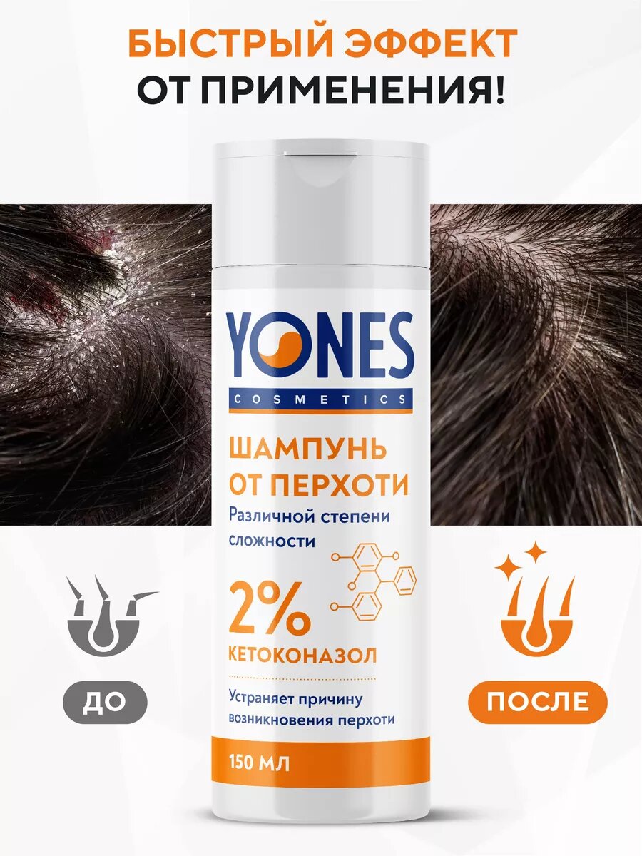 Изображение Шампунь YONES с кетоконазолом 2% от перхоти, для всех типов волос, 150мл