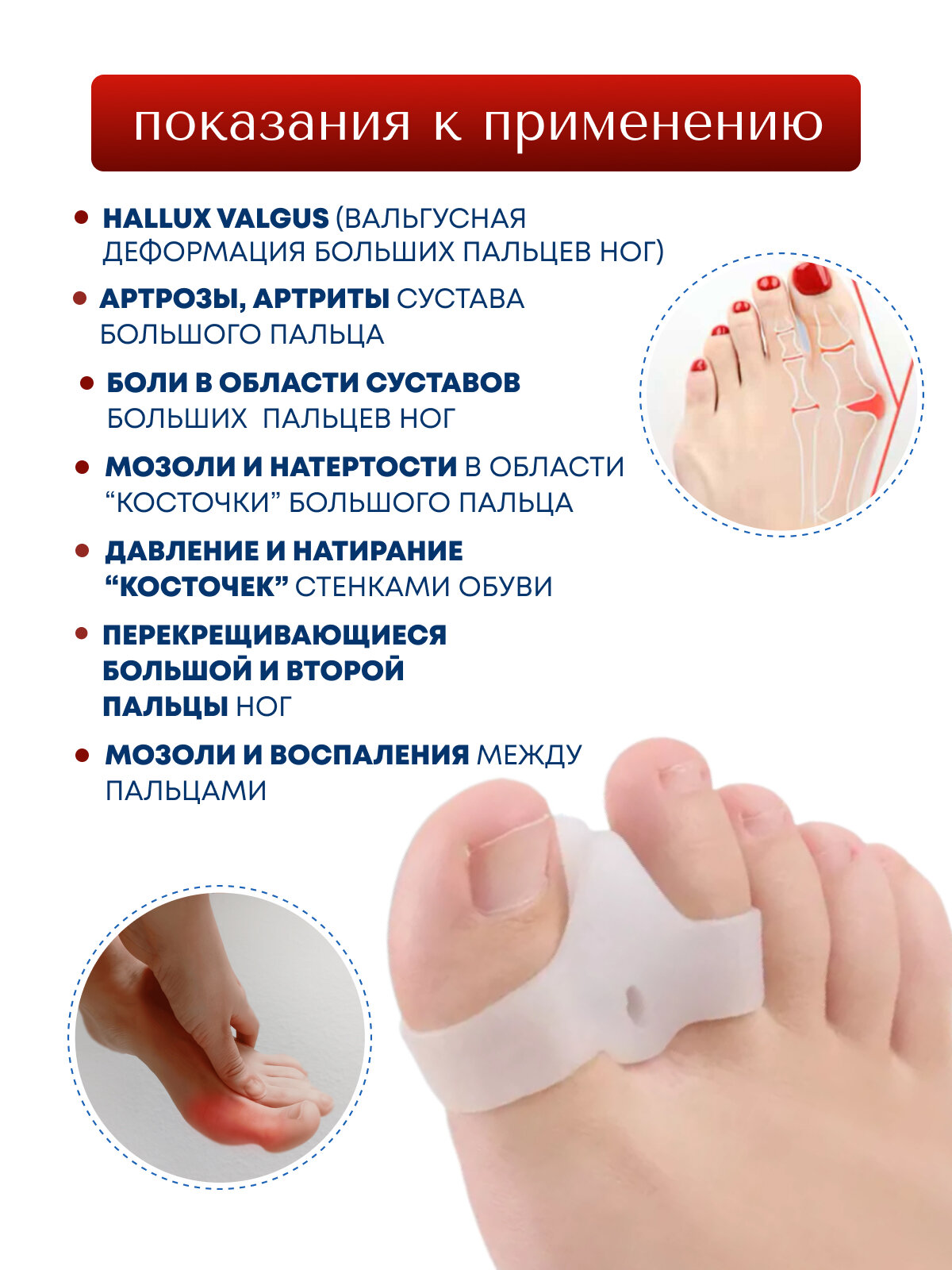 Картинки Корректор большого пальца MyBalance силиконовый с разделителем