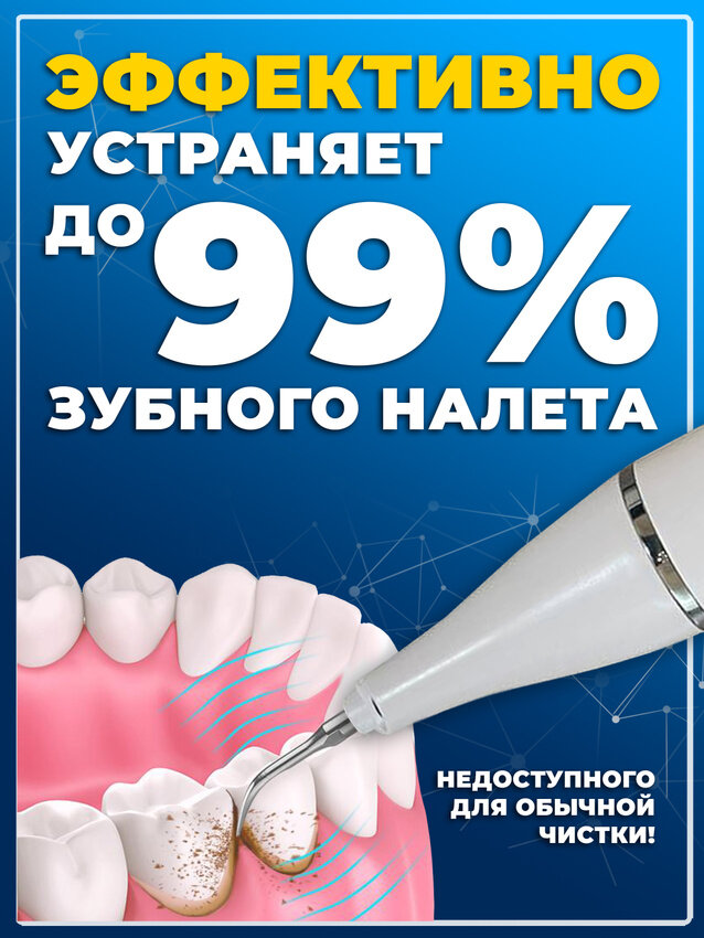 Скалер ультразвуковой, для удаления зубного камня, для чистки зубов, skaler — фото 1