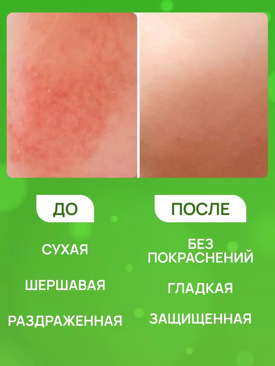 Изображение Крем Свобода детский 3 шт по 68 г