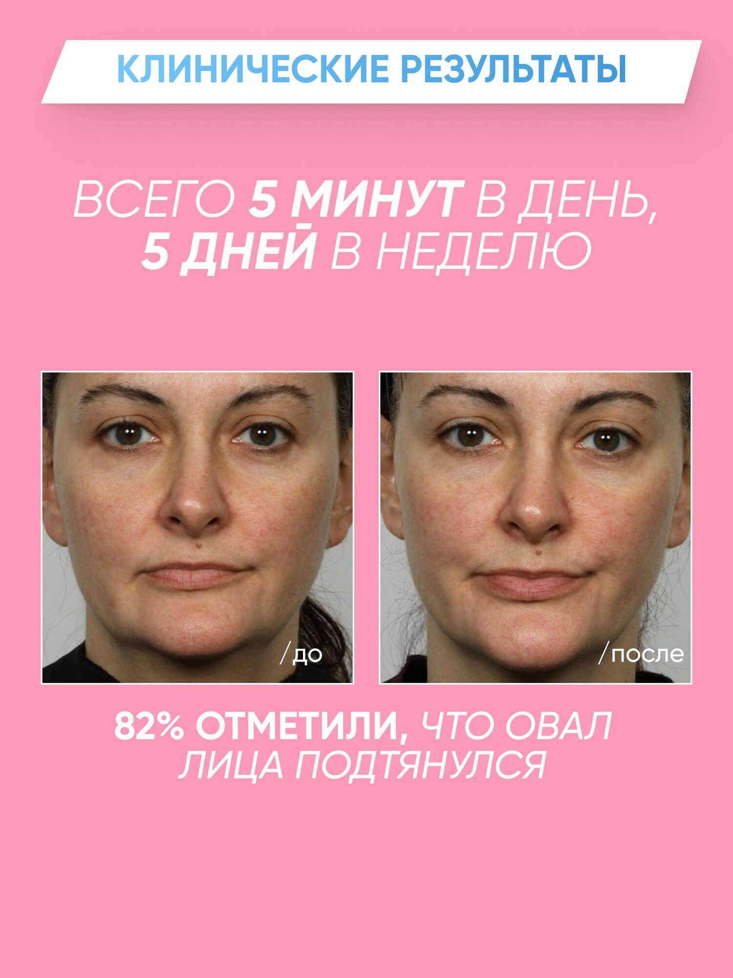 Микротоки — фото 1