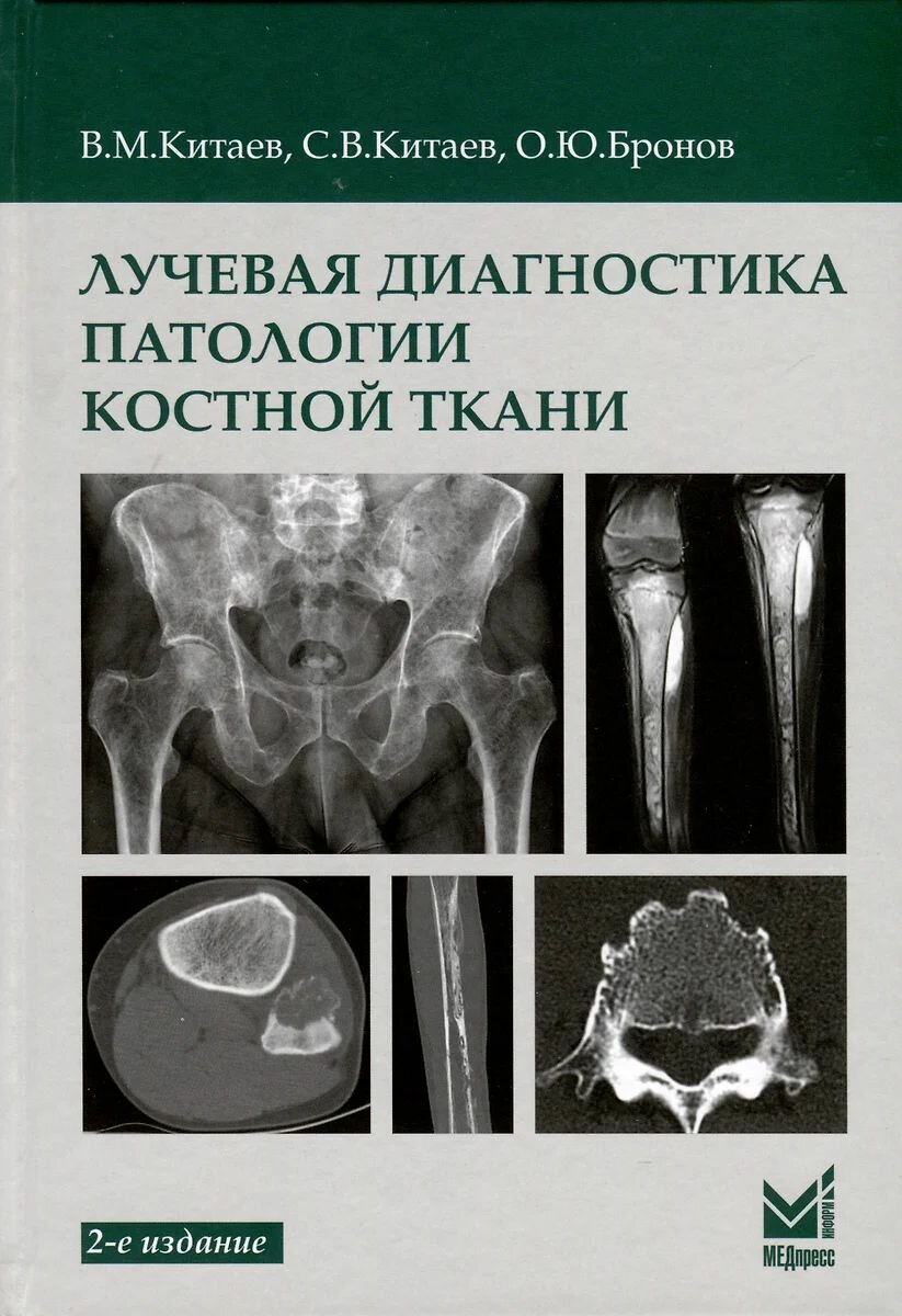 Книга МЕДпресс-информ Лучевая диагностика патологии костной ткани. 2 издание. 2024 год, В. и С. Китаевы, О. Бронов