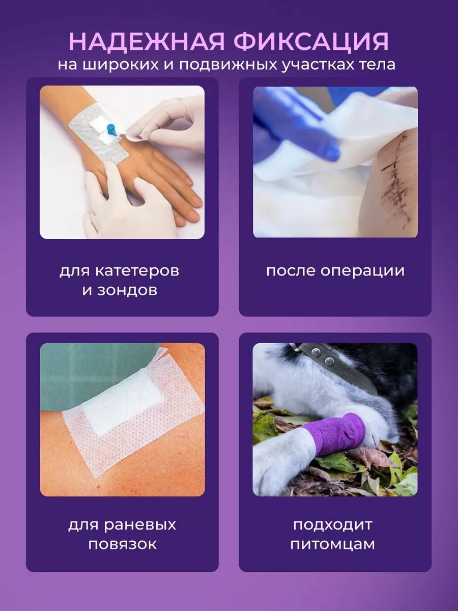 Изображение Лейкопластырь рулонный фиксирующий Teneris, 15 х 1000 см, пластырь повязка на нетканой основе