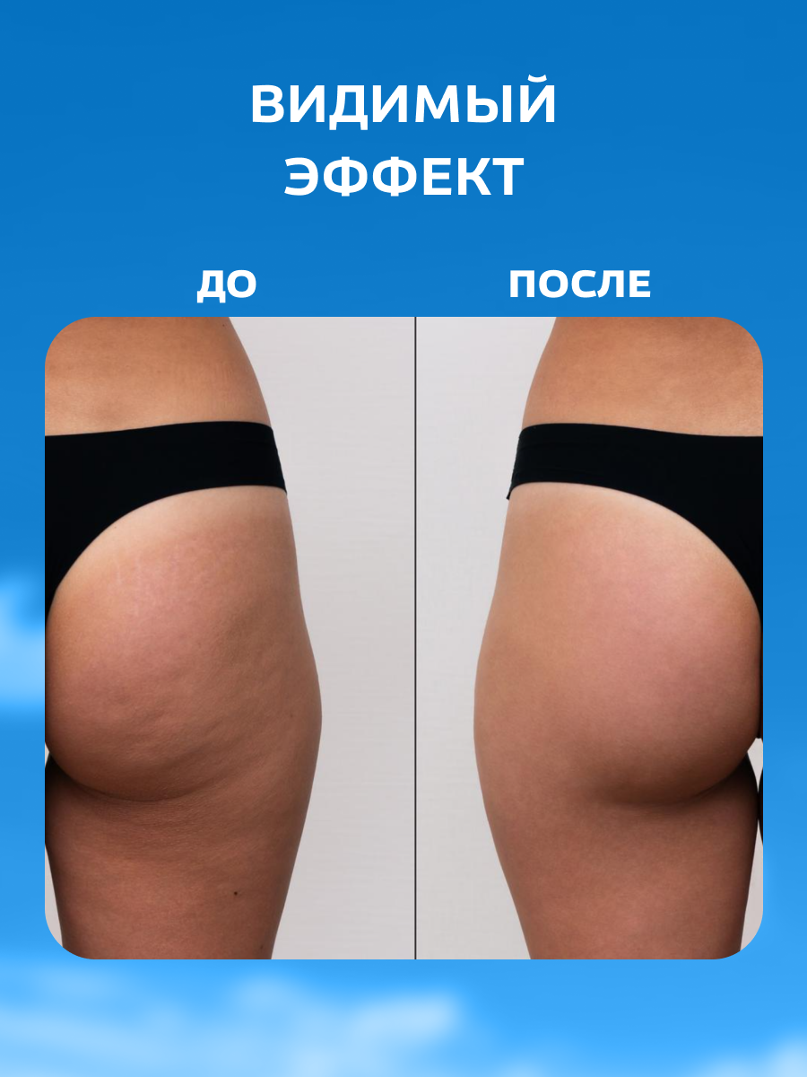 Средство Для Обертывания Обертывание для похудения контрастное Floresan Лимфодренаж 1000мл 4шт