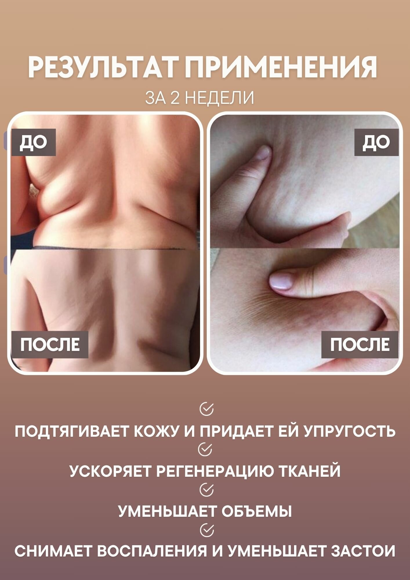 OLZORI Вакуумный массажер ReLive для спины и шеи, для ног, для тела антицеллюлитный лимфодренажный аппарат для похудения — фото 1
