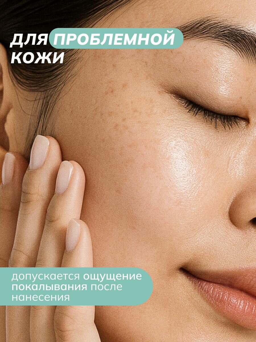 ART&FACT. / Сыворотка для проблемной кожи лица с азелаиновой кислотой 10% и ниацинамидом 2%, 30 мл — фото 1