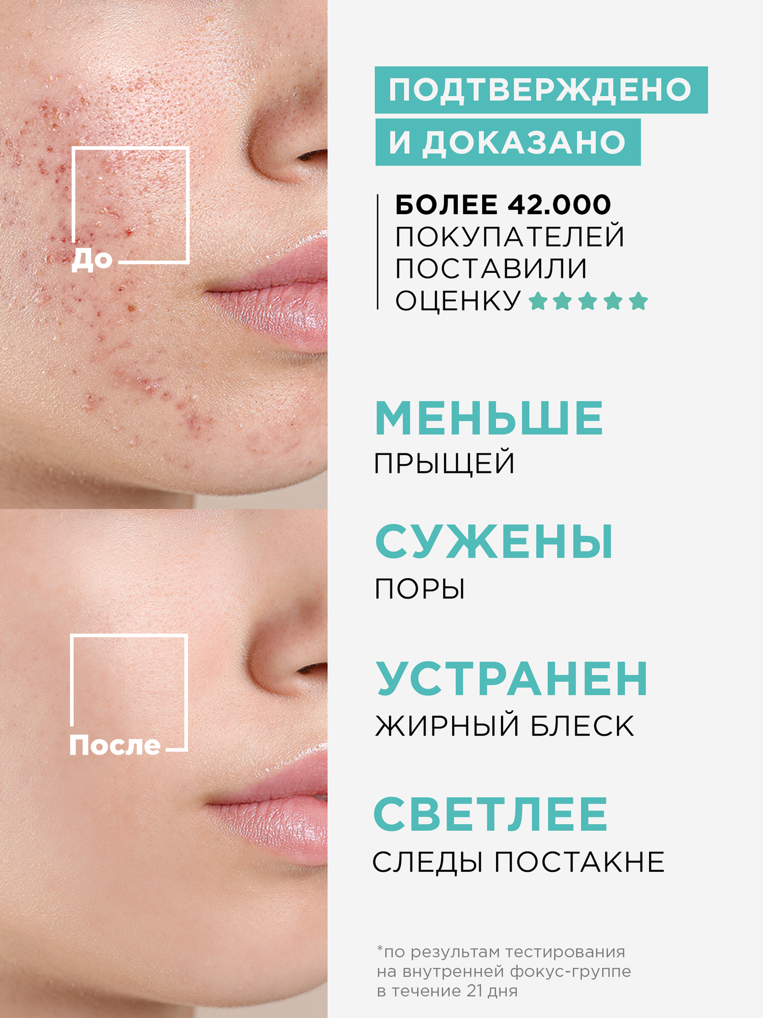 Изображение MIXIT Набор сывороток SKIN CHEMISTRY, для всех типов кожи, против прыщей