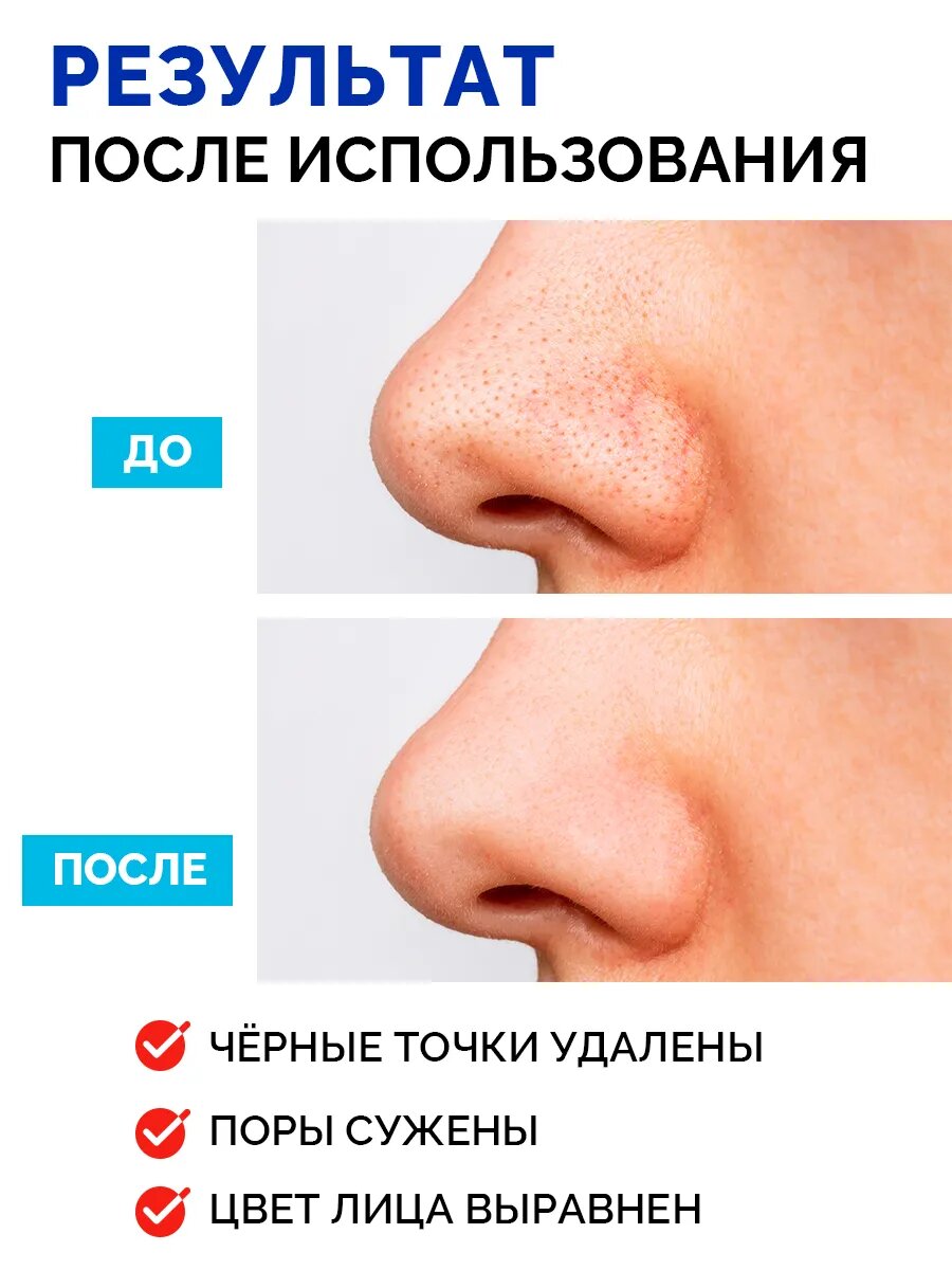 Пропеллер Очищающие салициловые полоски для носа, от черных точек 6 шт. — фото 1