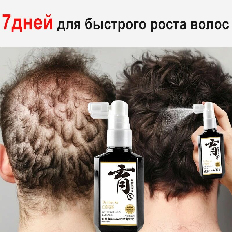 Спрей-сыворотка для роста волос, Средство от выпадения волос у женщин и мужчин, их роста и укрепления, 60 мл.