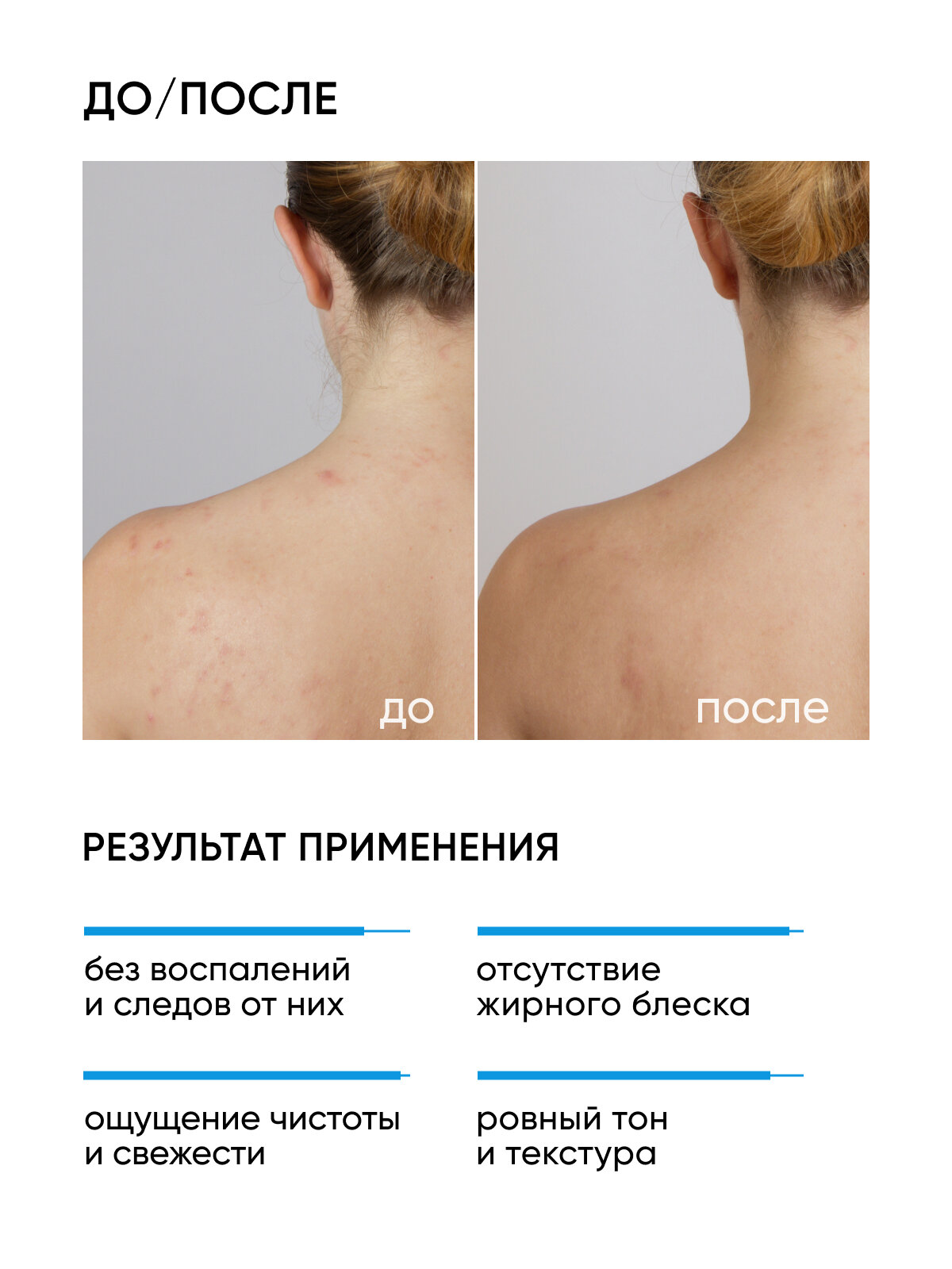 Гель очищающий для лица и тела с салициловой кислотой и цинком для жирной и комбинированной кожи ICON SKIN RE: PROGRAM, 250 мл — фото 1