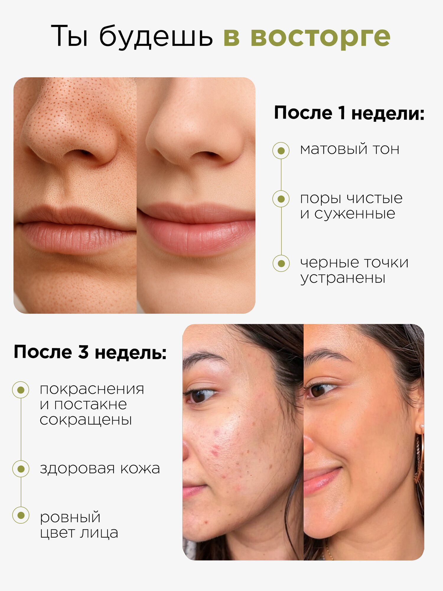 MIXIT Гель для умывания лица очищающий матирующий от прыщей, акне, черных точек — фото 1