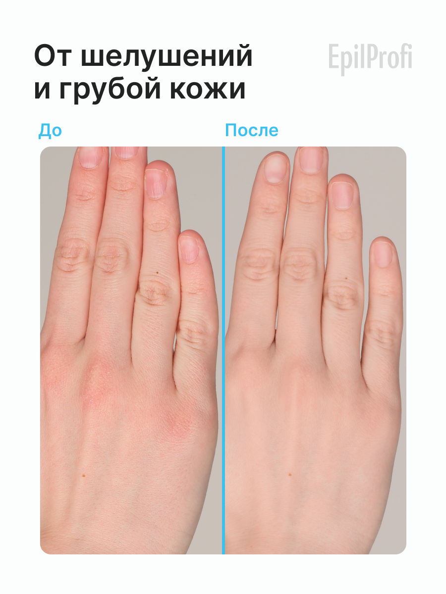 Набор EpilProfi, для рук и ног, восстановление, питание, увлажнение — фото 1