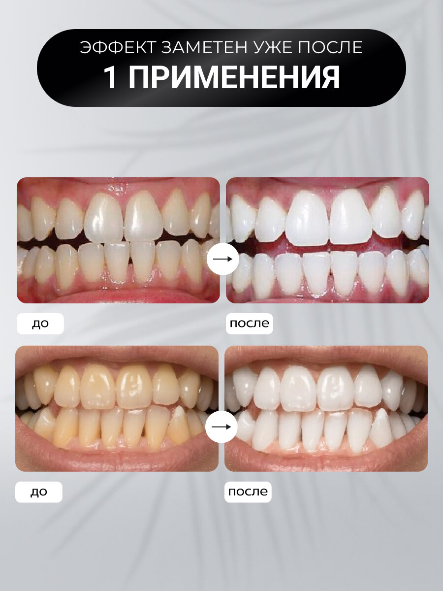 Картинки Полоски для отбеливания зубов Полоски отбеливающие Безопасное отбеливание 7 шт PARU