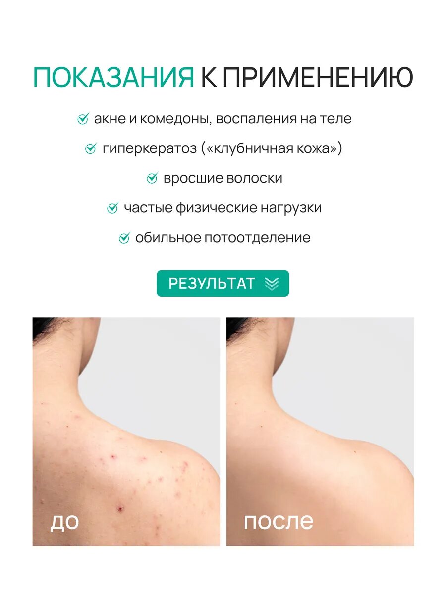 Гель для душа от прыщей с кислотами AHA+BHA 250 мл — фото 1