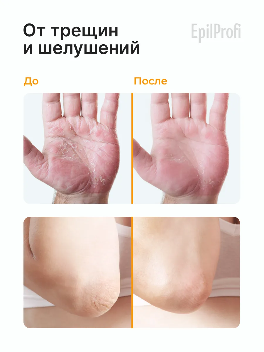 Крем воск от трещин для сухой кожи EpilProfi, кокосовое масло, пчелиный воск, 100 мл — фото 1