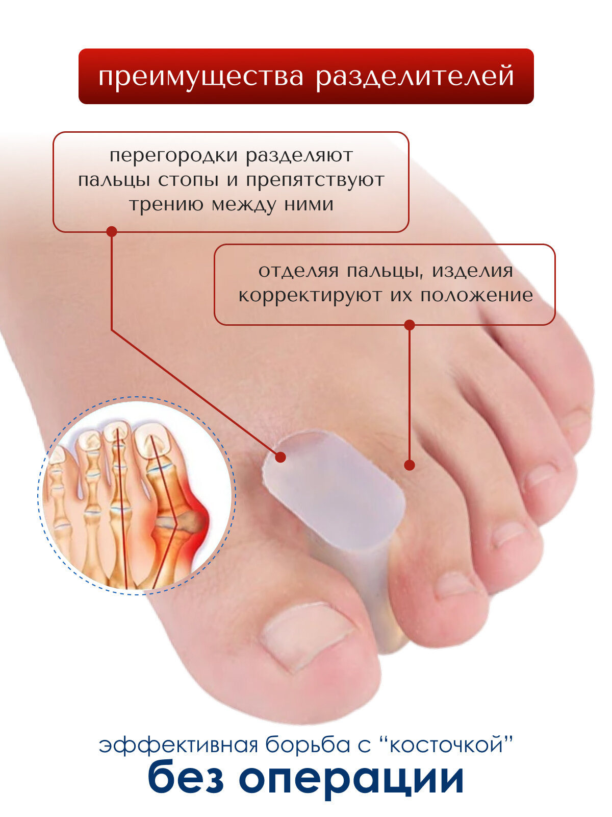 Изображение Разделитель для пальцев MyBalance, при деформации пальцев, белый, силиконовый, 2 шт, размер L