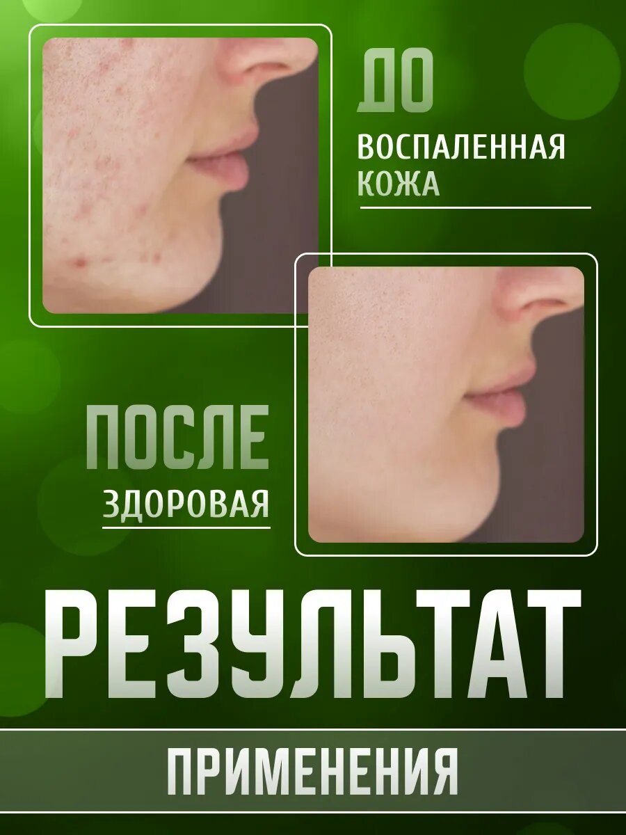 ПКК Весна Главаптека мыло дегтярное туалетное твердое кусковое 2 шт по 90 г / Мыло для рук, для лица, для тела — фото 1