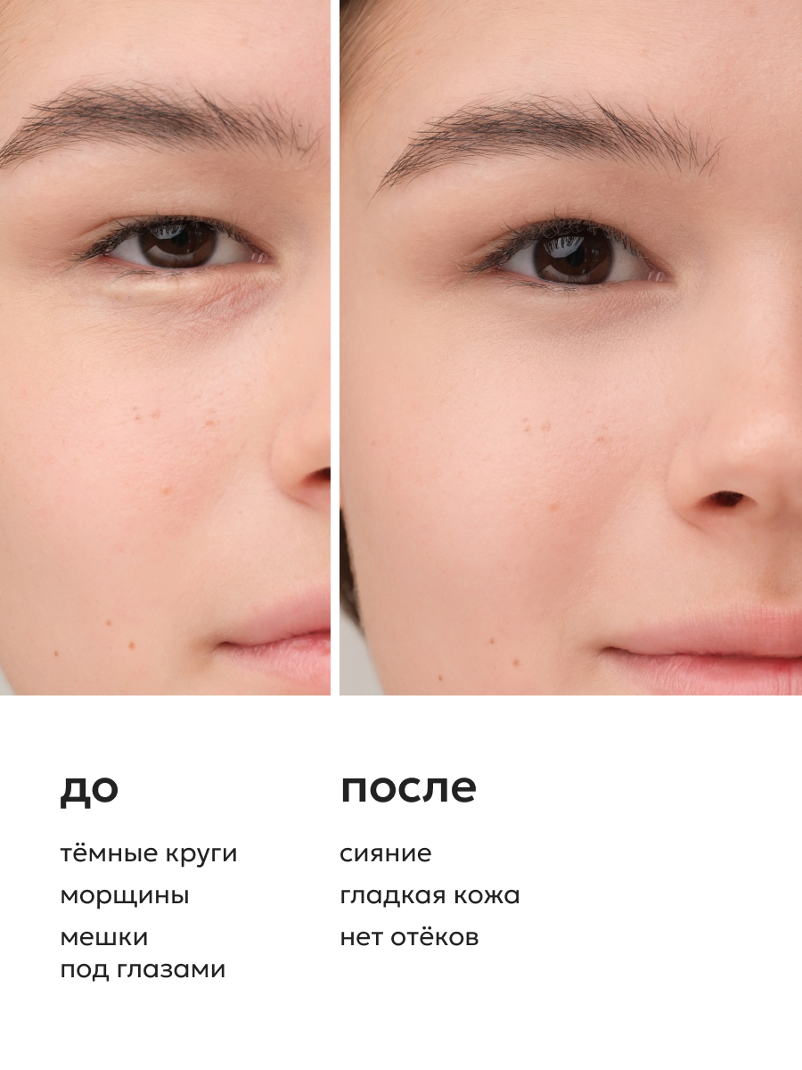 Гели Для Физиотерапии Век Likato Professional Гель флюид для кожи вокруг глаз от отеков, морщин, темных кругов под глазами, 20 мл