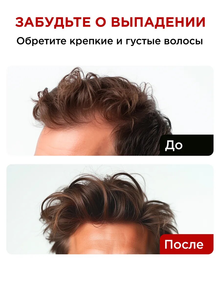 Препараты От Заболеваний Кожи Головы MIXIT Маска для роста волос, шампунь от выпадения и массажер для кожи головы Grow Pro