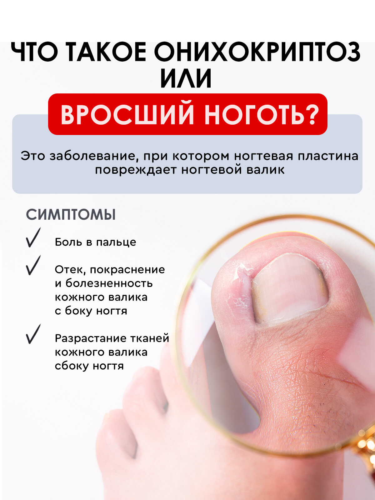 Картинки Бальзам для кутикулы против вросших ногтей INKI "STOP Онихокриптоз", 10мл