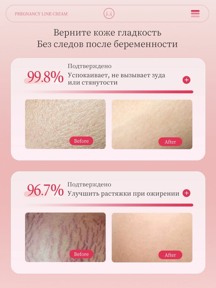 Картинки Средство от растяжек