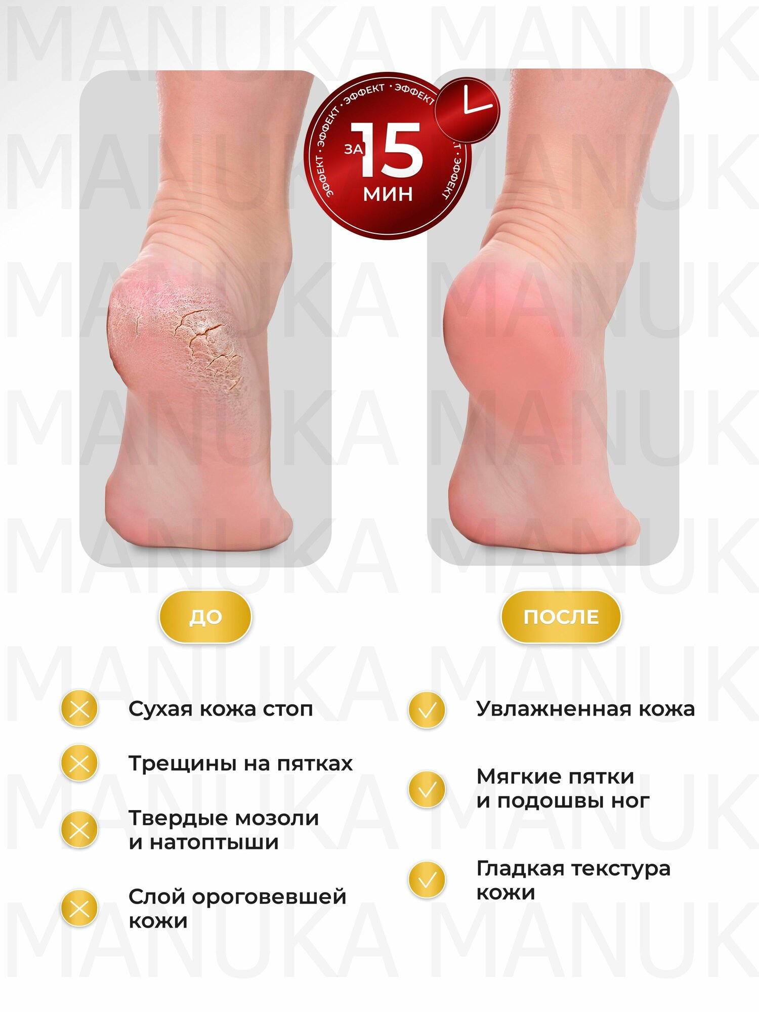 Маски Для Ног ZOZU Носочки для педикюра одноразовые, маска для ног с экстрактом авокадо, носки для смягчение пяток 6 шт