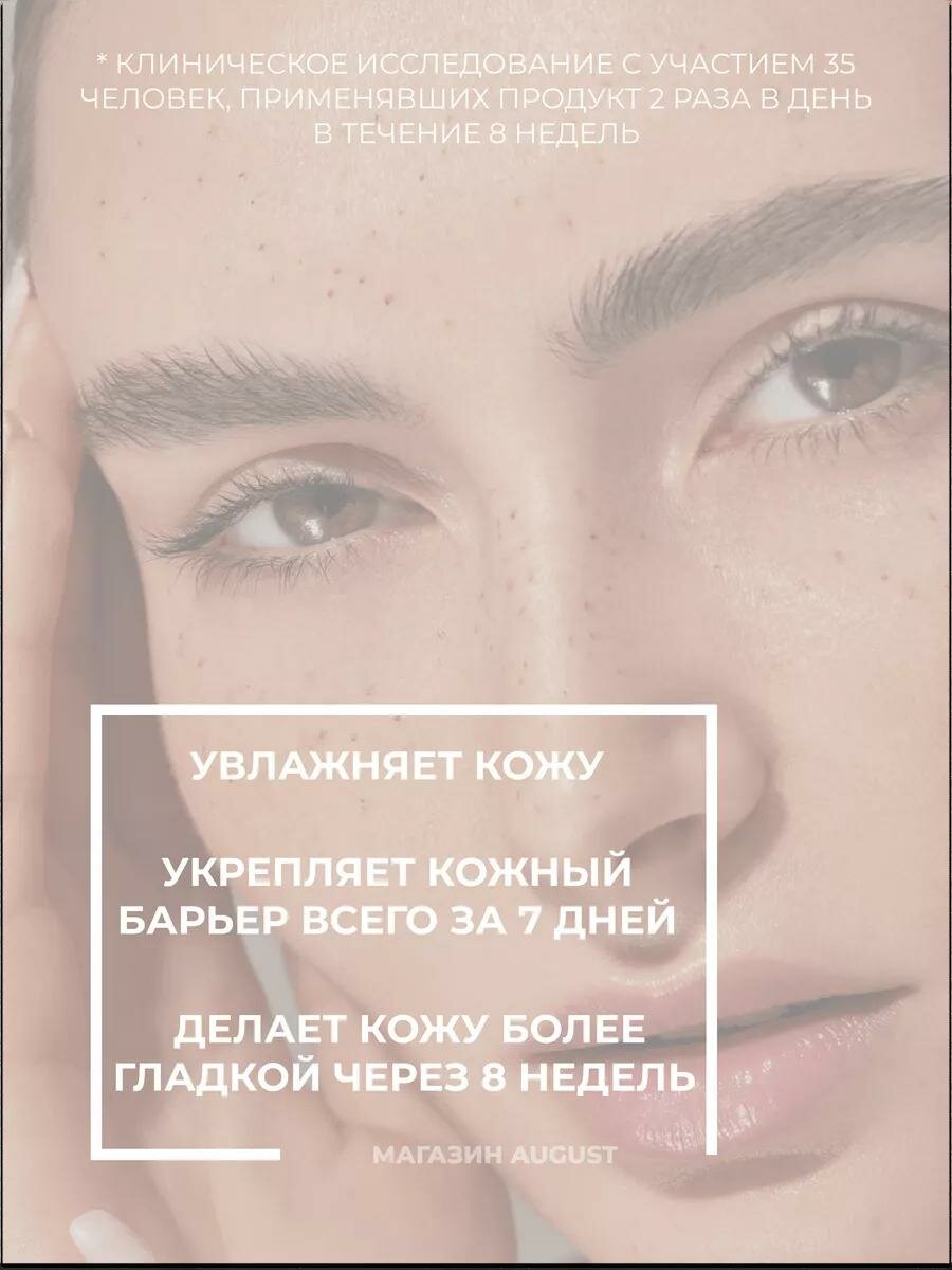 Средство от угрей и прыщей The Ordinary сыворотка — фото 1