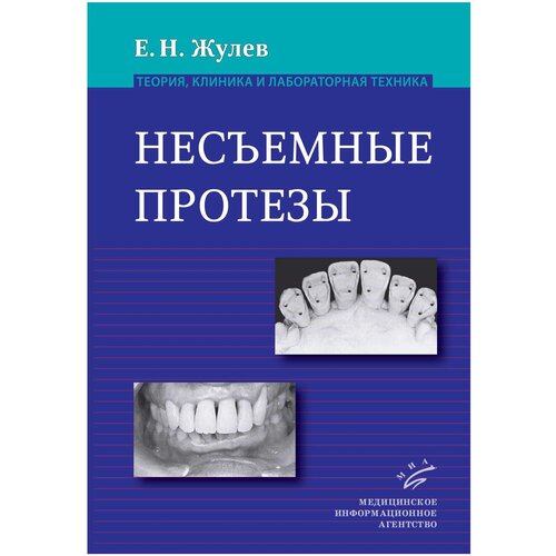 Несъемные протезы. Теория, клиника и лабораторная техника