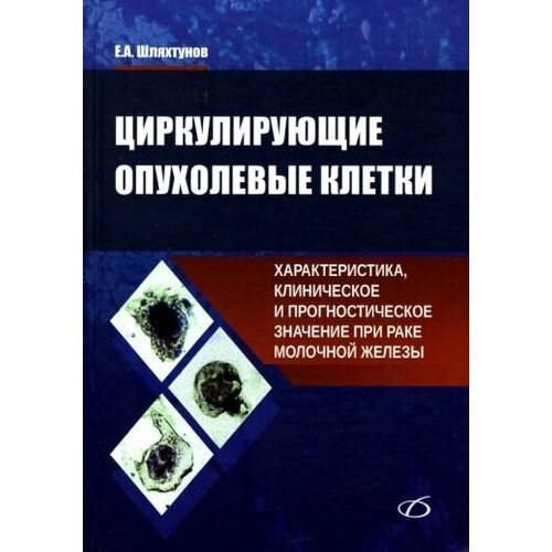 Евгений шляхтунов: циркулирующие опухолевые клетки. характеристика, клиническое и прогностическое значение при раке