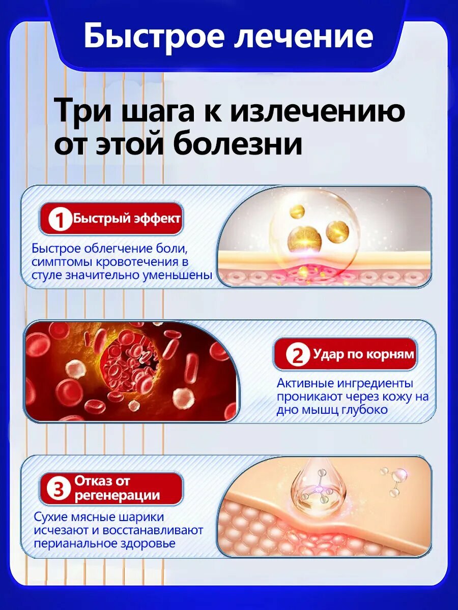 Изображение Мазь от геморроя китайская, боль, отек анального отверстия и другие симптомы, вызванные геморроем.