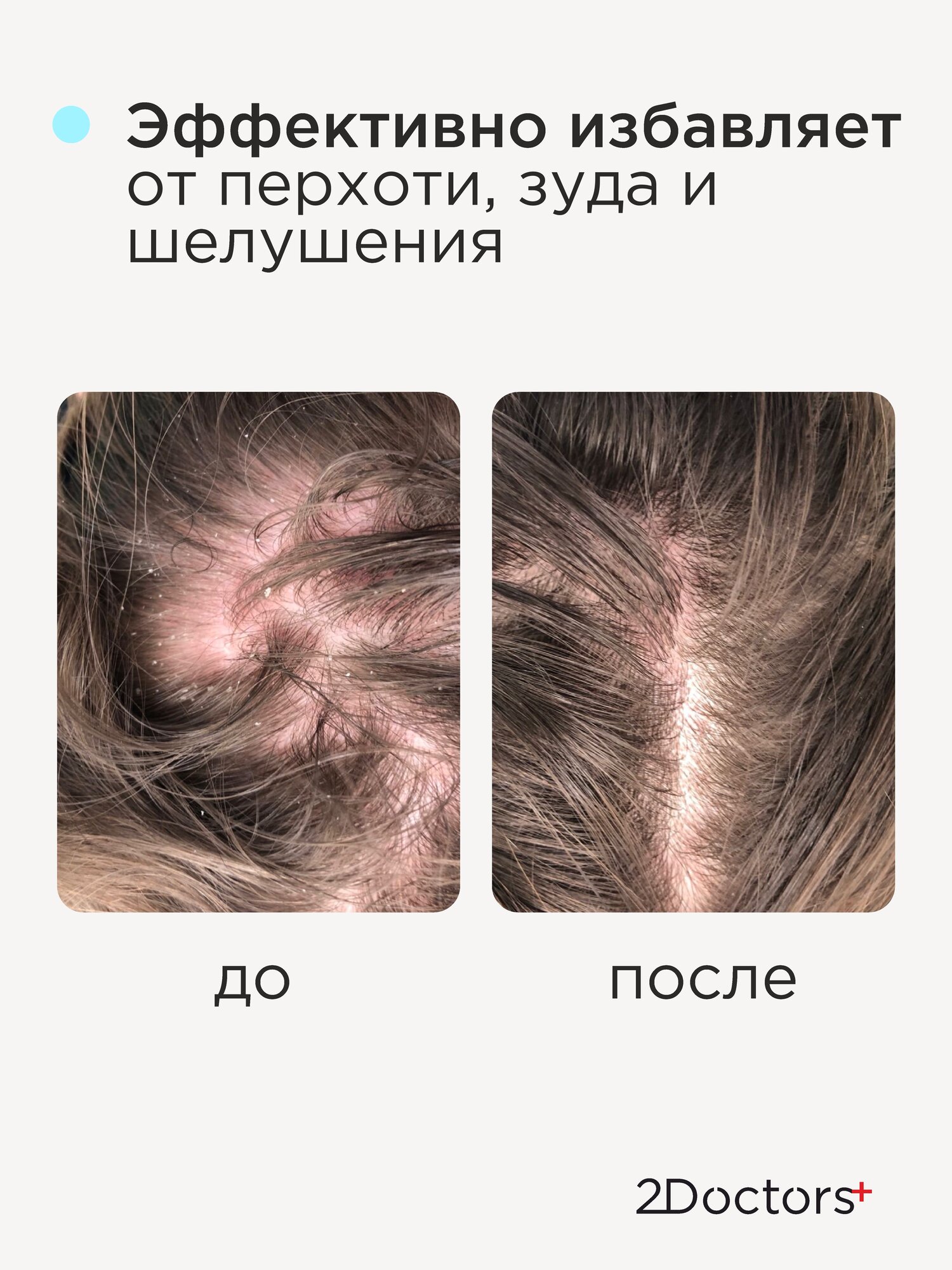 Картинки Шампунь от перхоти "Климбазол+Пироктон оламин+Цинк+Салициловая кислота", 250 мл