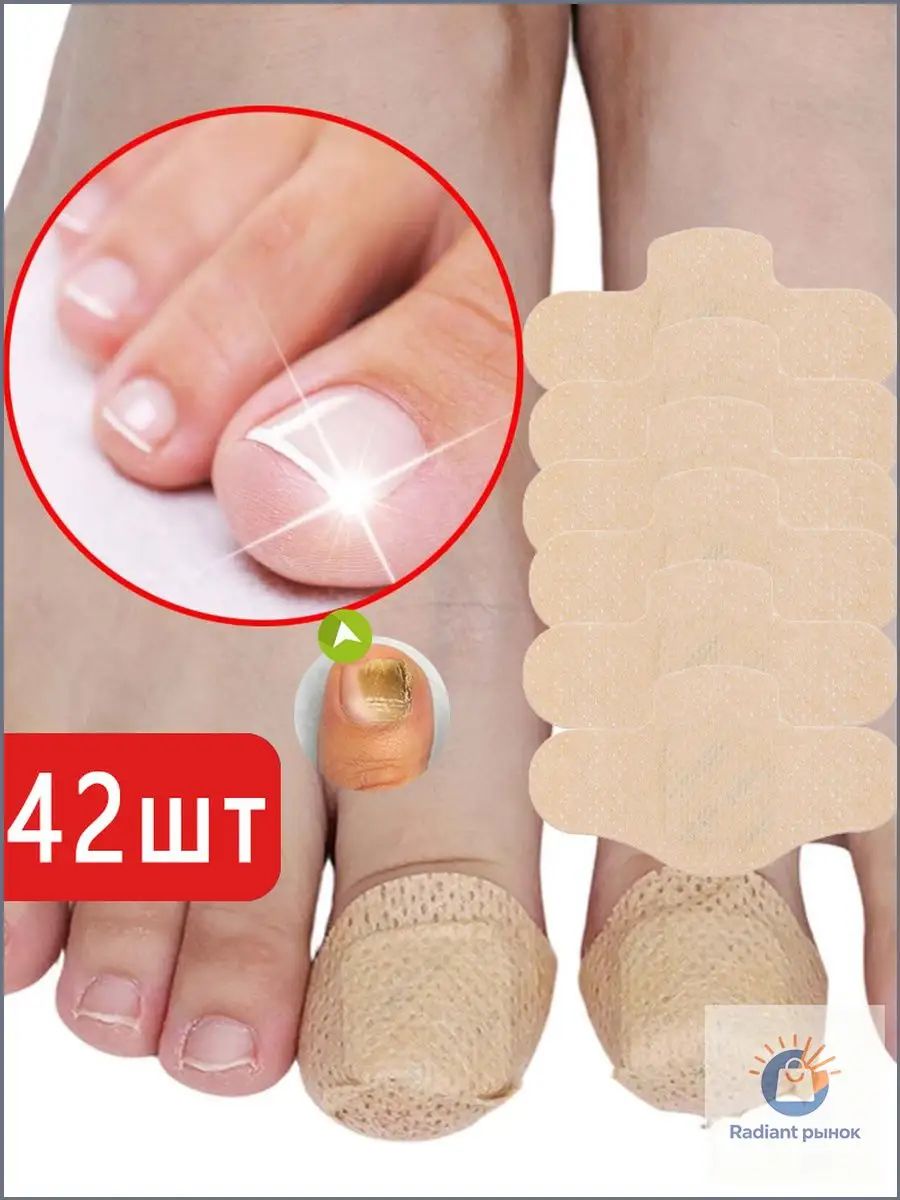 Пластырь для лечения ногтей для борьбы с грибком, коррекции ногтей, 42 штук