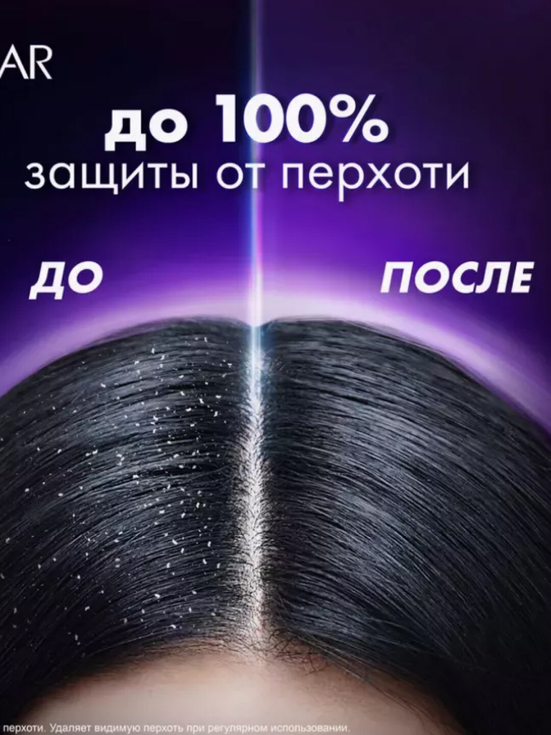 Шампунь Clear Woman "Макс объем", против перхоти, для придания объема, 380 мл — фото 1