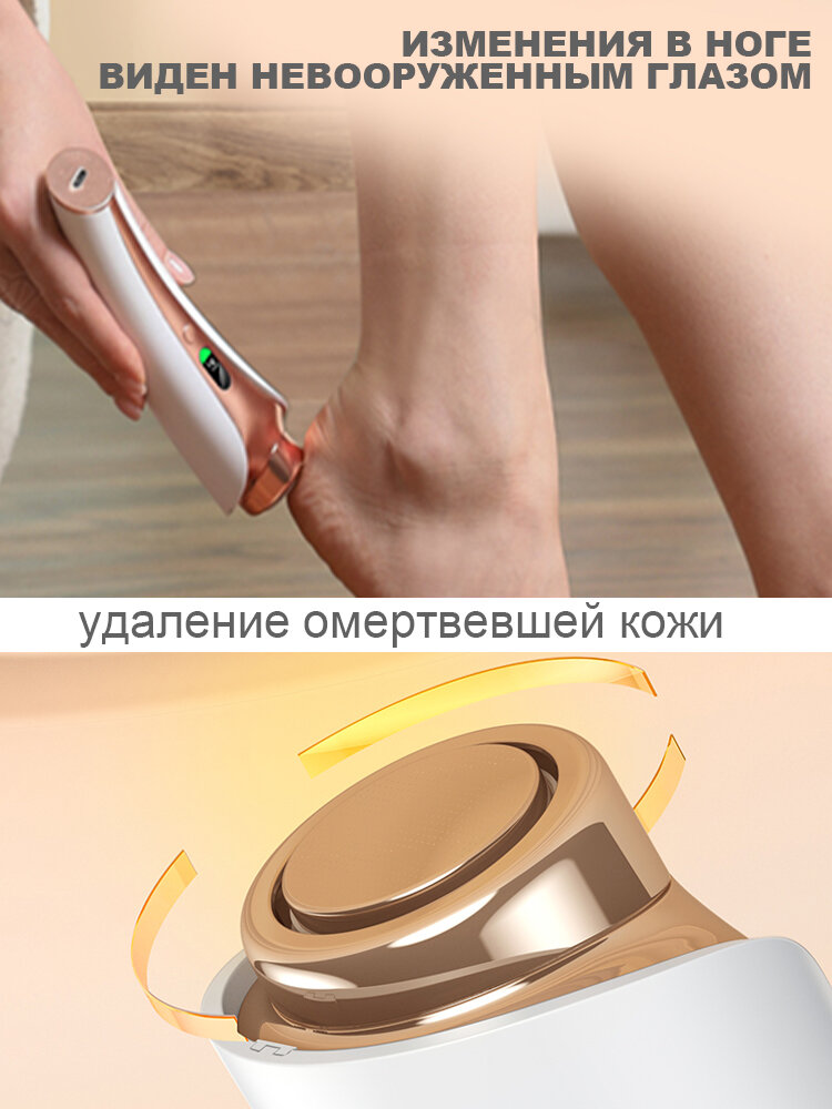 Изображение Электрическая пилка для пяток, с наностекляными насадками, IPX6, 3 мес. работы, белая