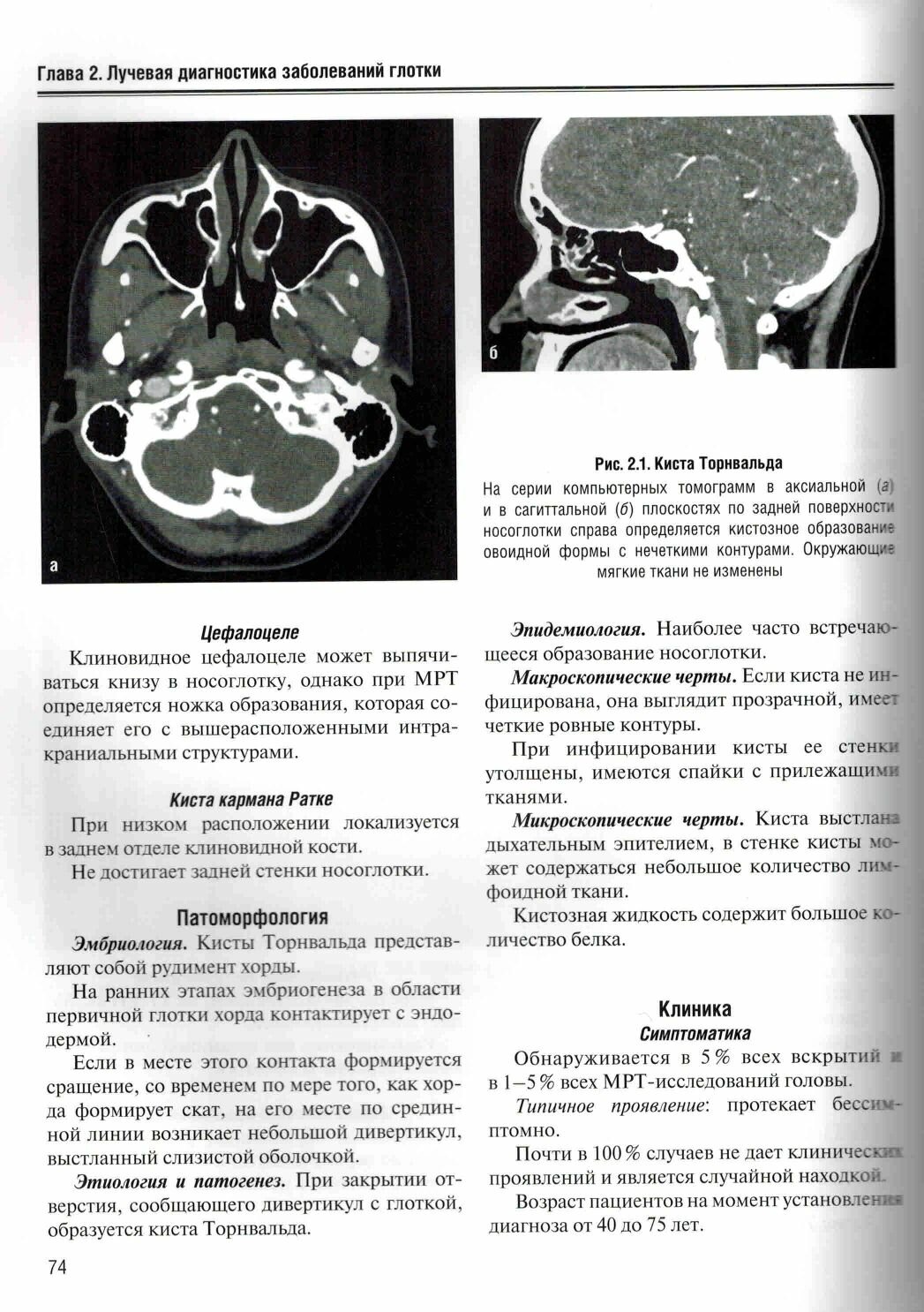 Визуализация заболеваний шеи — фото 1