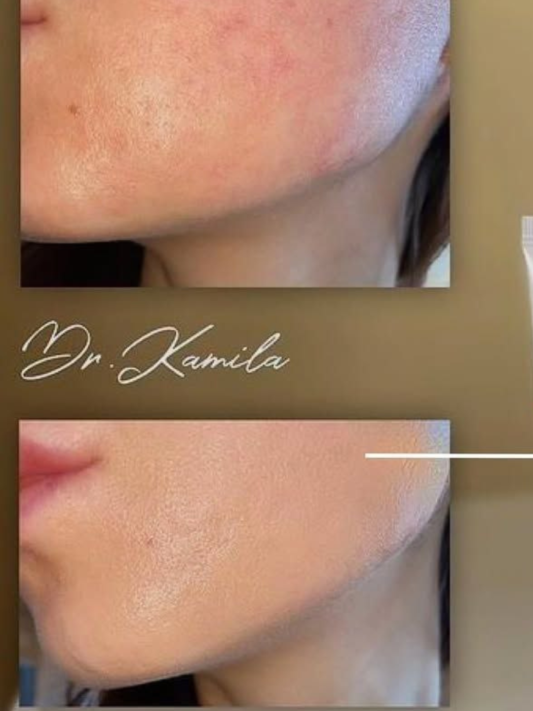 Yuz uchun krem Dr.CPU Natural Skin CC Cream Spf 50+ PA +++