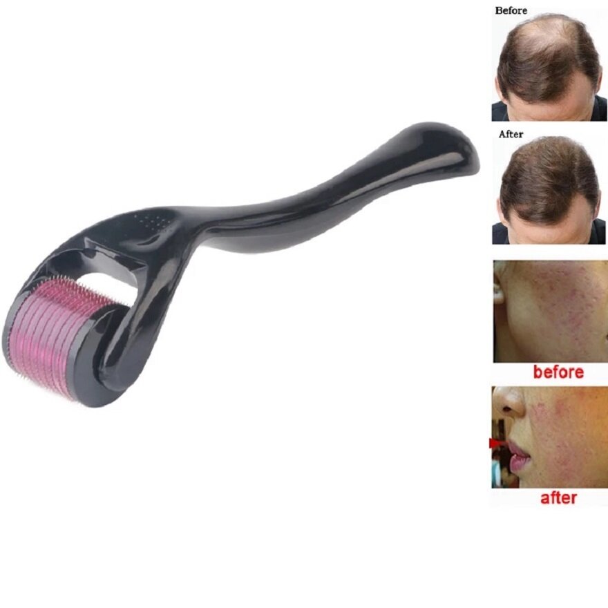 Аксессуары Мезороллер "Derma rolller system" для лица, волос и бороды 540 игл по 0,5 мм — фото 1