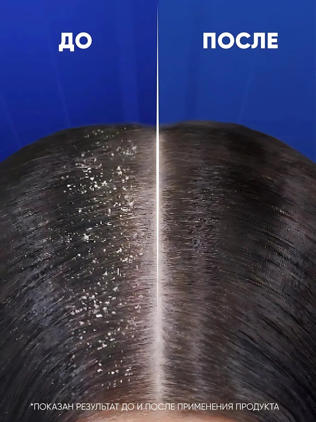 HEAD&SHOULDERS Шампунь 2в1 Ментол осв/Энерг океана Микс400мл — фото 1