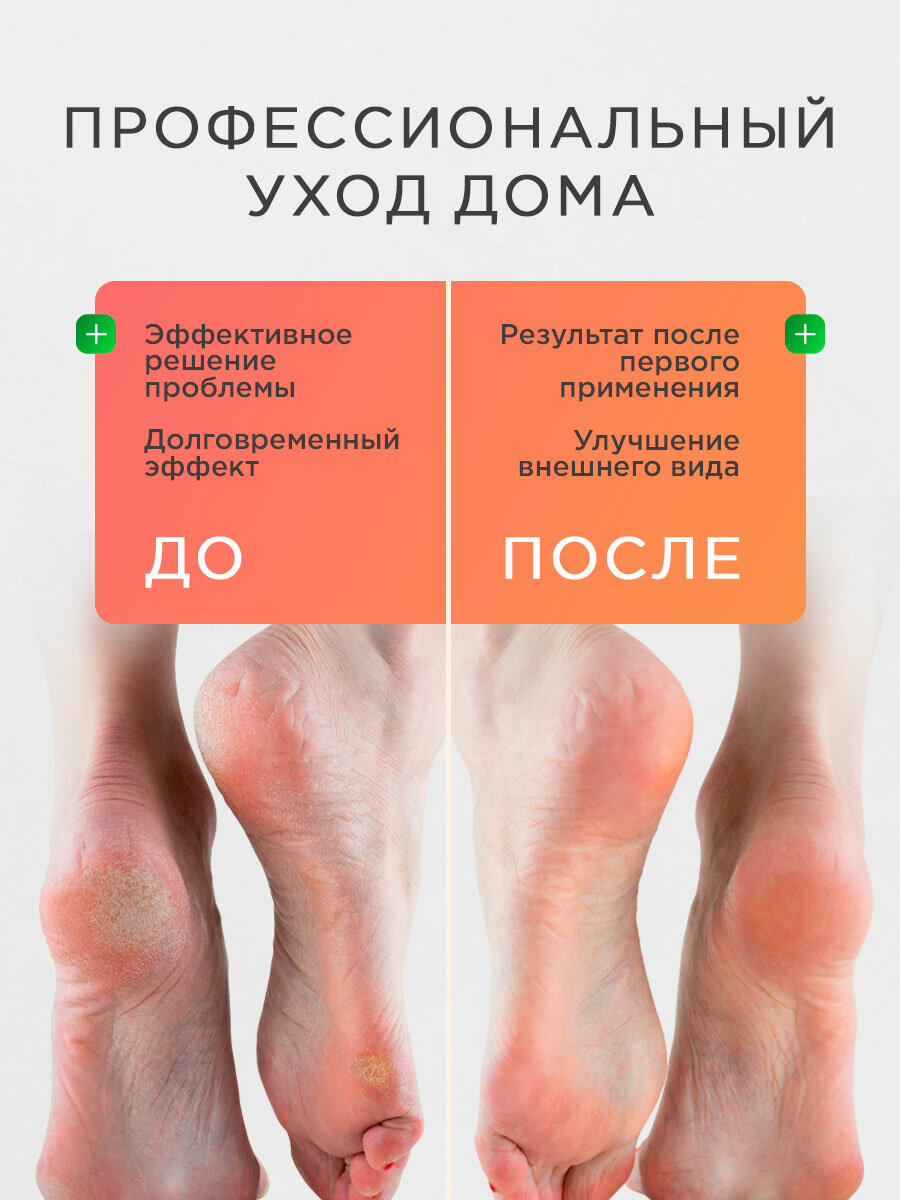 Маски Для Ног Пилинг носочки педикюрные для ног NSC, маска отшелушивающая с кислотами, 1уп / 1 пара / 40гр.