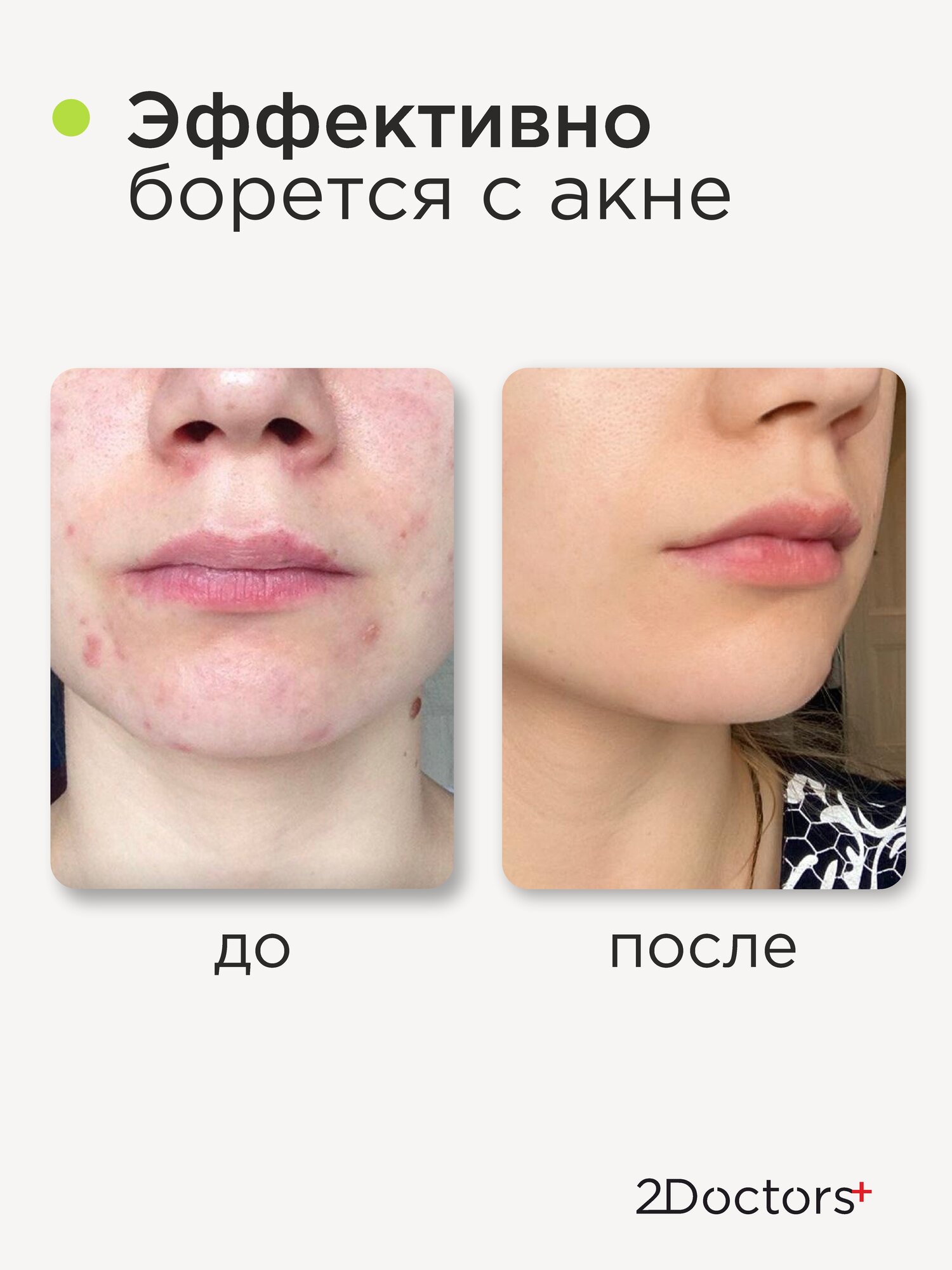 Изображение Тоник для лица от прыщей №14 "AHA кислоты + Цинк PCA" 2Doctors, 100 мл