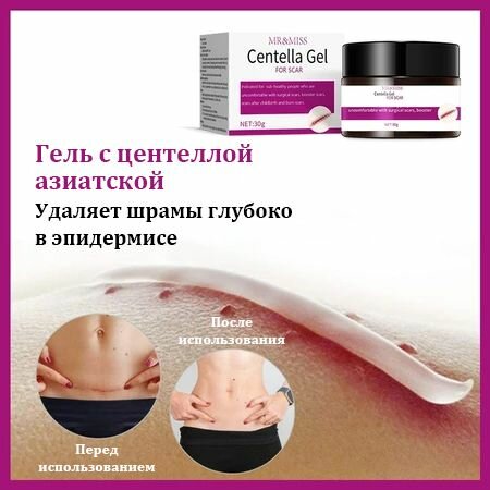 Лекарства От Растяжек MR&MISS Крем от растяжек 30 г для беременных после родов от растяжек рубцов для упругости кожи на животе
