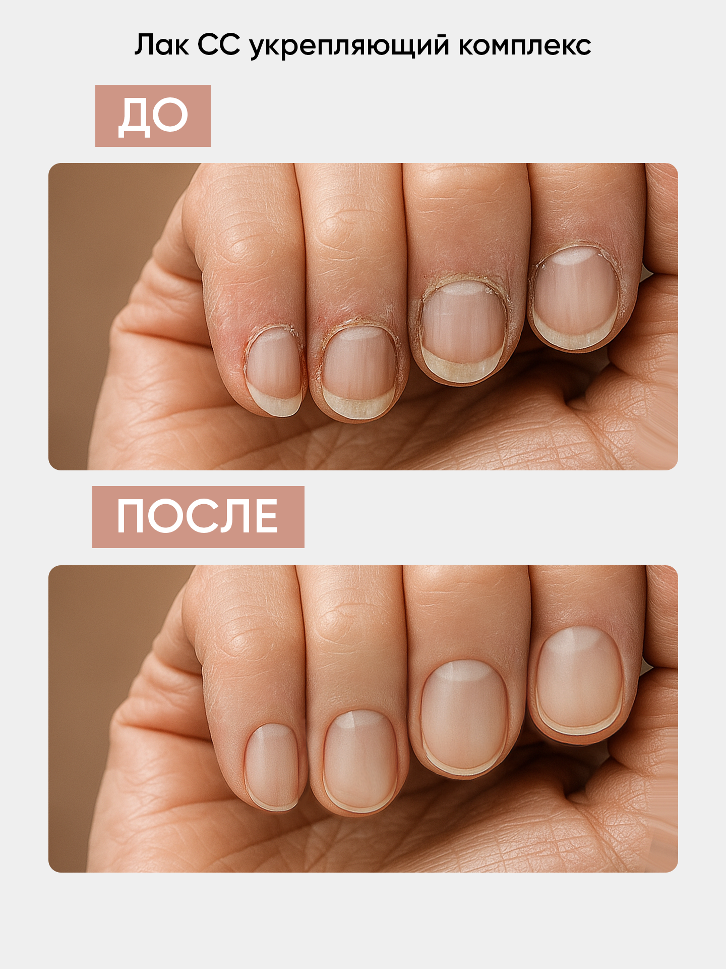 Лак для ногтей камуфлирующий Антифунгал MicoStop CC от Patrisa Nail, 8 мл — фото 1