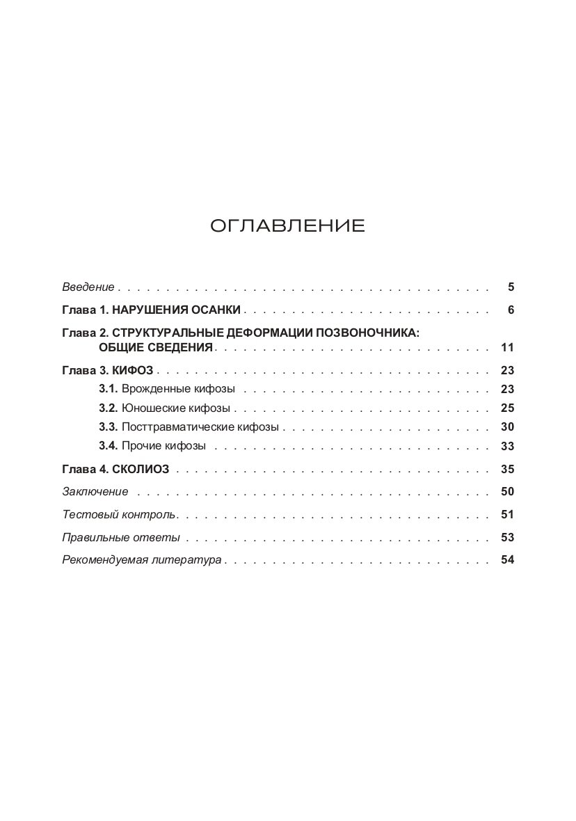 Деформации позвоночника — фото 1