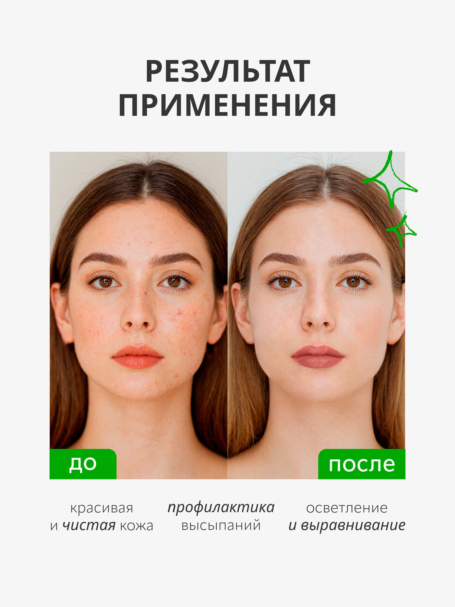Крем для лица Monic Beauty What is Clean анти акне успокаивающий, 50 мл — фото 1