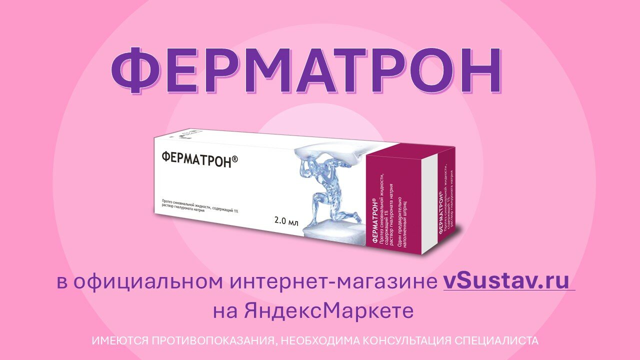 Протезы Внутрисуставной Жидкости ФЕРМАТРОН® раствор для внутрисуставного введения на основе гиалуроновой кислоты, 1% (10 мг/мл), 2 мл