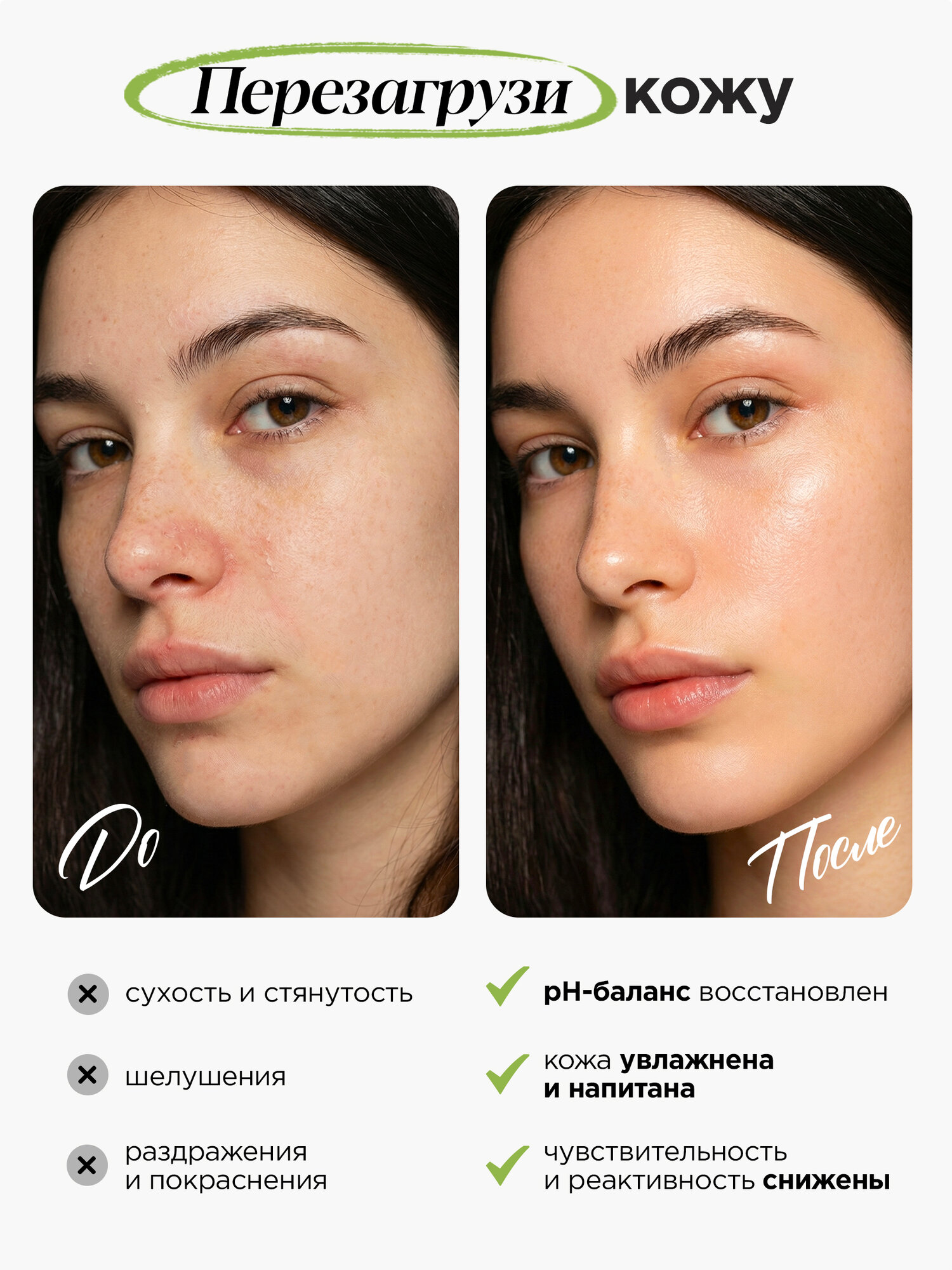 MIXIT Молочный тоник для лица косметический с экстрактом нони. — фото 1