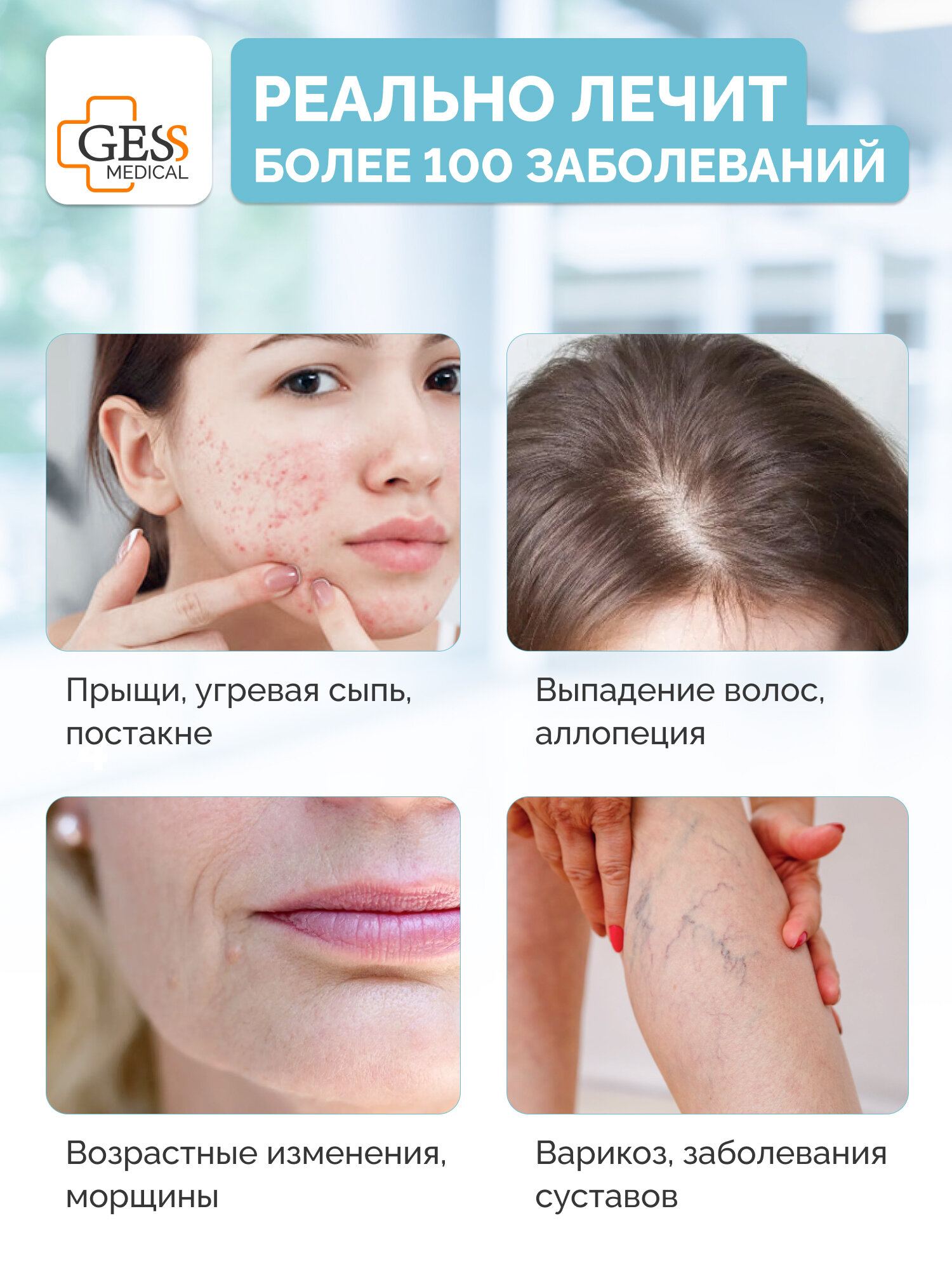 Аппарат дарсонваль медицинский импульсный GESS DARS для лица, для волос, для тела, 5 насадок — фото 1