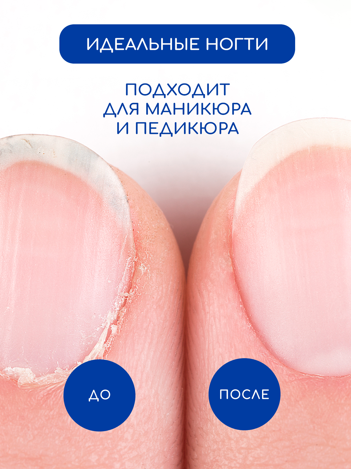 Средства Для Кутикулы Ремувер средство для удаления для кутикулы Инки гелевый, 30мл